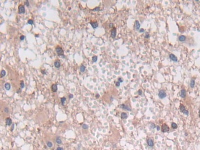 可溶性半乳糖凝集素3結(jié)合蛋白(LGALS3BP)多克隆抗體
