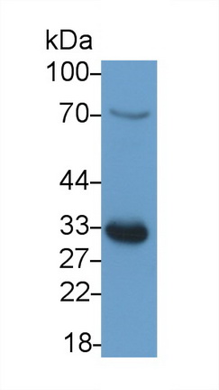 可溶性半乳糖凝集素3結(jié)合蛋白(LGALS3BP)多克隆抗體