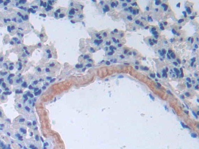可溶性半乳糖凝集素3结合蛋白(LGALS3BP)多克隆抗体