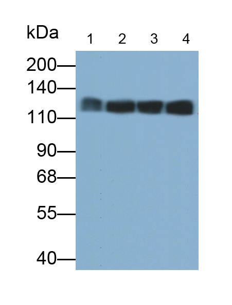 微小染色体维持缺陷蛋白2(MCM2)多克隆抗体