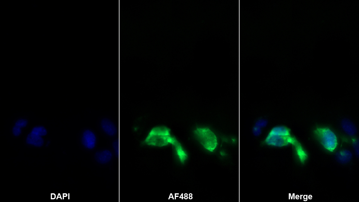 S100鈣結(jié)合蛋白A6(S100A6)多克隆抗體