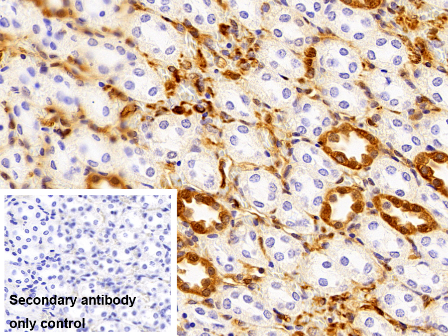 S100鈣結(jié)合蛋白A6(S100A6)多克隆抗體