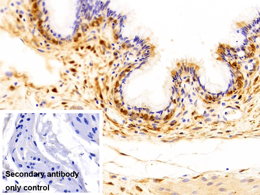 S100鈣結(jié)合蛋白A6(S100A6)多克隆抗體