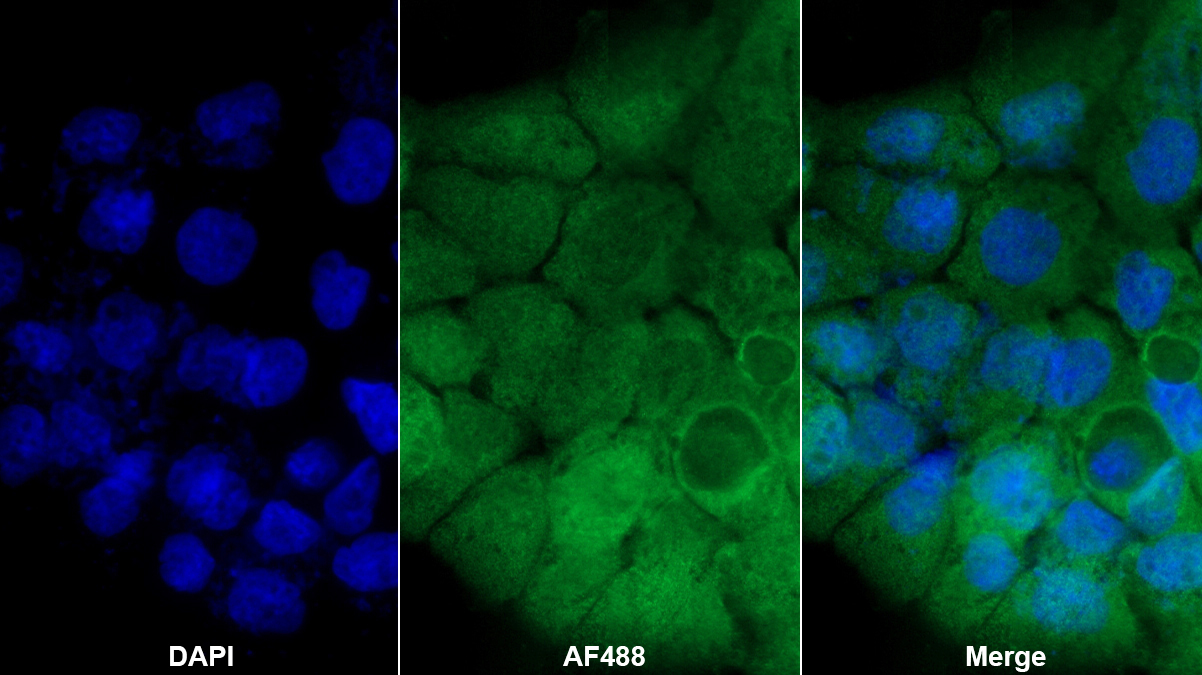 鳥苷酸結(jié)合蛋白4(GBP4)多克隆抗體