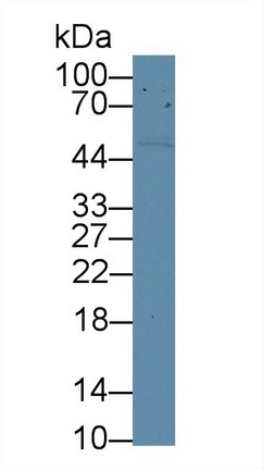 CD5分子(CD5)多克隆抗体