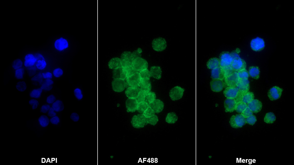 CD5分子(CD5)多克隆抗體