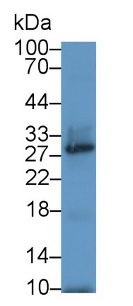 尿嘧啶核苷磷酸化酶1(UPP1)多克隆抗体