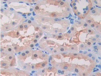β-位淀粉樣前體蛋白裂解酶2(BACE2)多克隆抗體