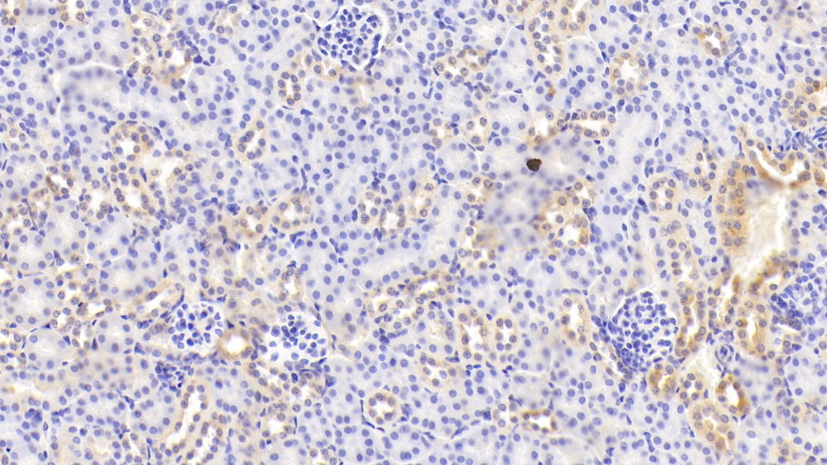 β-位淀粉樣前體蛋白裂解酶2(BACE2)多克隆抗體