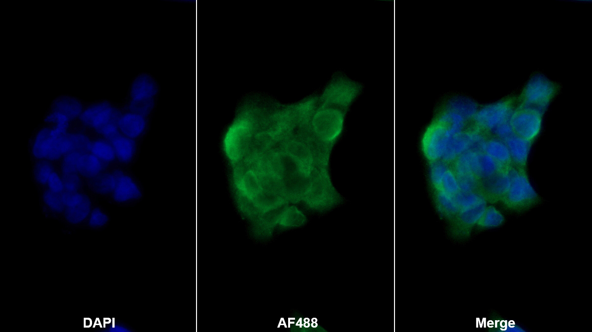鳞状细胞癌抗原1/2(SCCA1/SCCA2)多克隆抗体