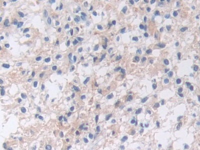 解整合素金属蛋白酶9(ADAM9)多克隆抗体