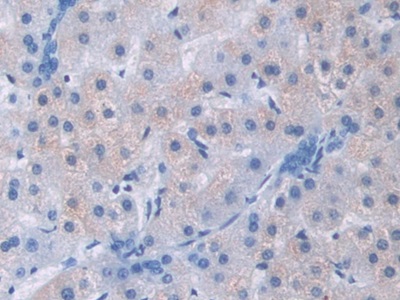 解整合素金属蛋白酶9(ADAM9)多克隆抗体