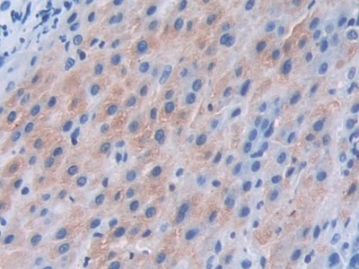 解整合素金属蛋白酶9(ADAM9)多克隆抗体