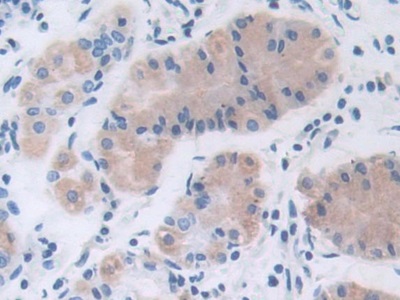 解整合素金属蛋白酶9(ADAM9)多克隆抗体