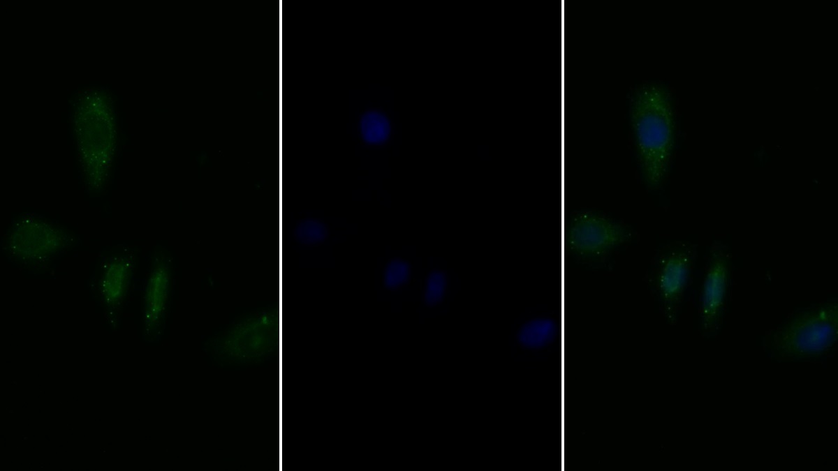 白介素2受体α(IL2Ra)多克隆抗体