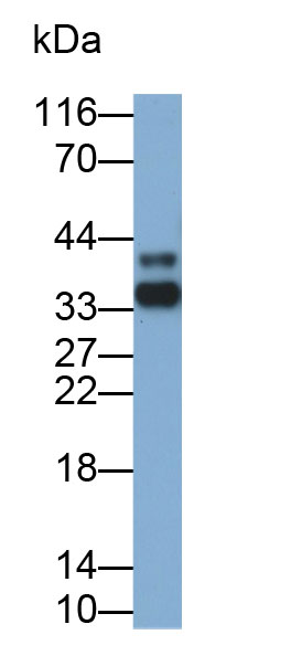白介素2受体α(IL2Ra)多克隆抗体