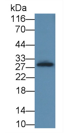 白介素2受体α(IL2Ra)多克隆抗体