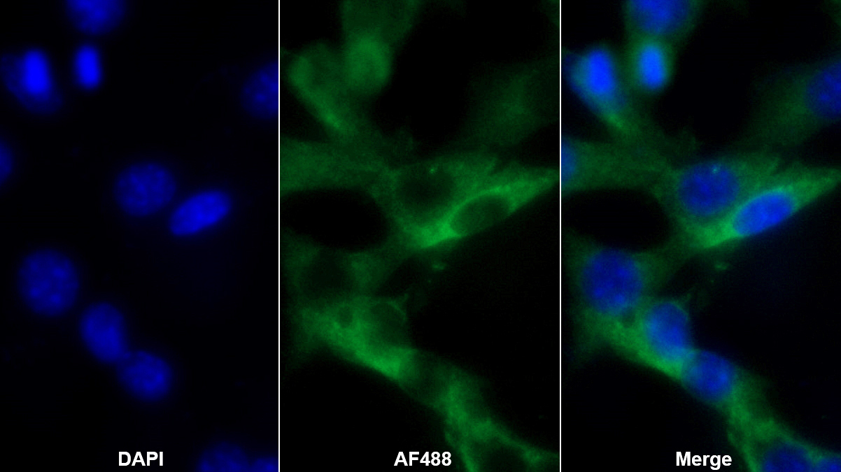 樁蛋白(PXN)多克隆抗體
