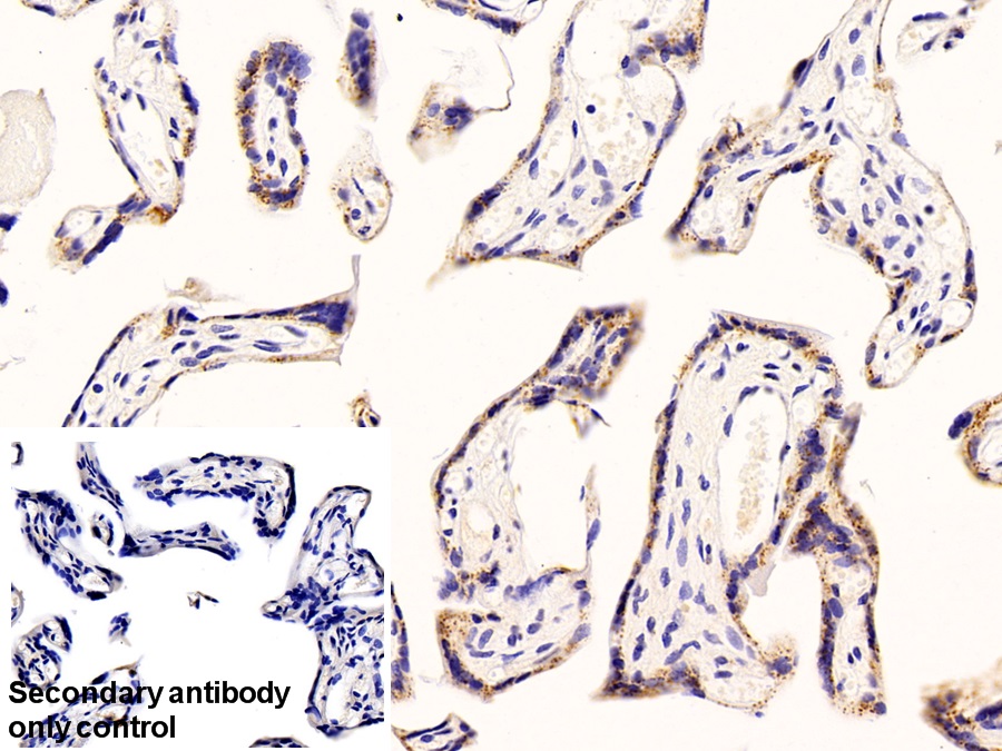 β-1,4-半乳糖转移酶1(b4GALT1)多克隆抗体