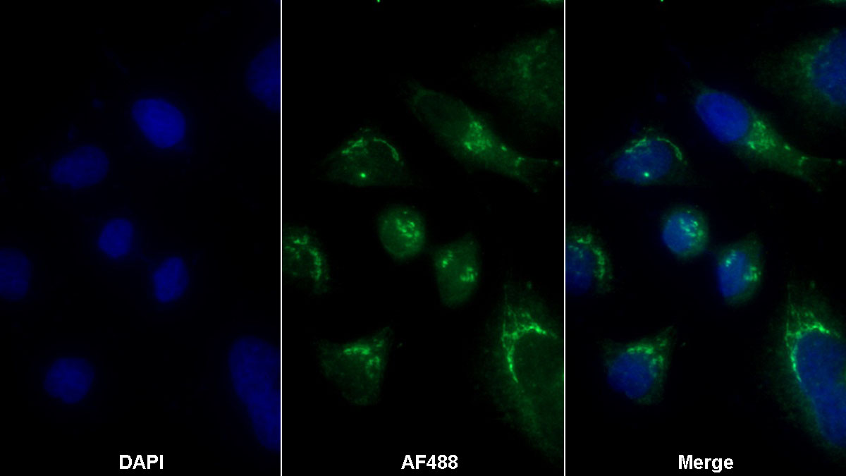 β-1,4-半乳糖转移酶1(b4GALT1)多克隆抗体
