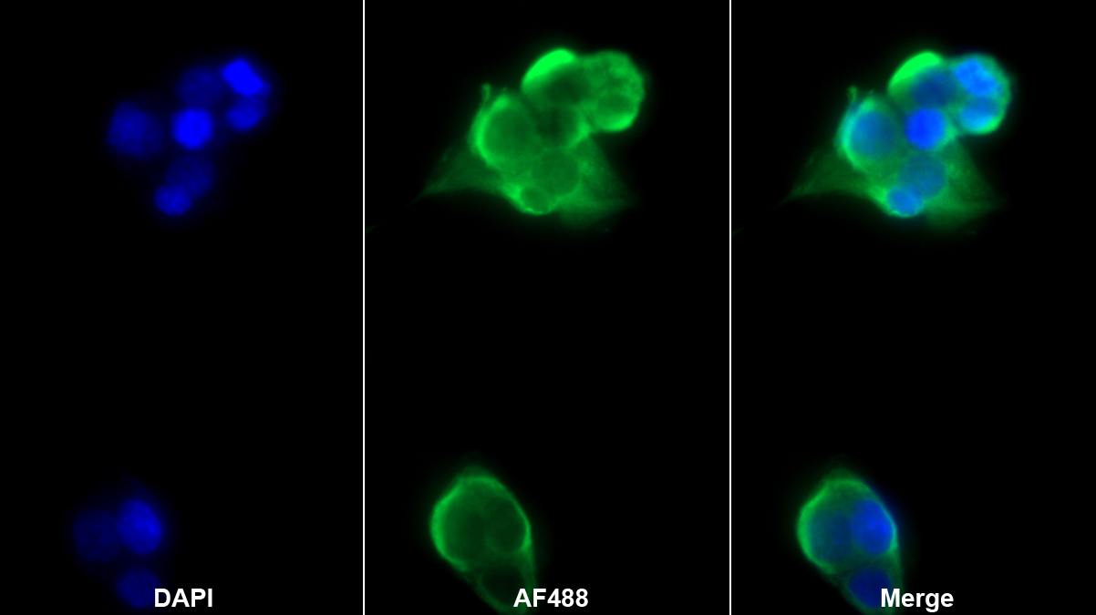 胎球蛋白B(FETUB)多克隆抗体