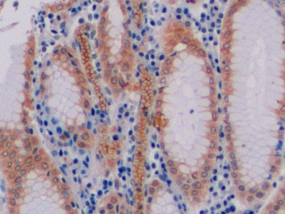 CD19分子(CD19)多克隆抗体