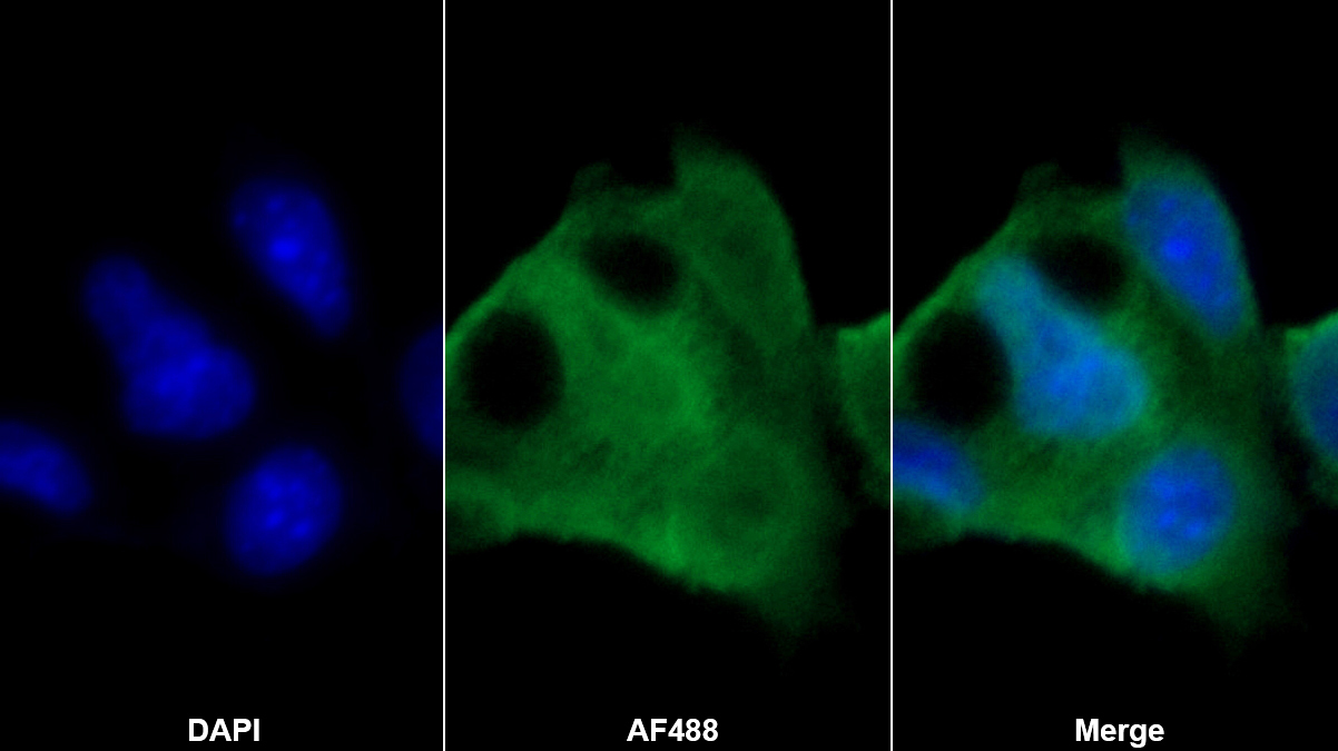 载脂蛋白C3(APOC3)多克隆抗体