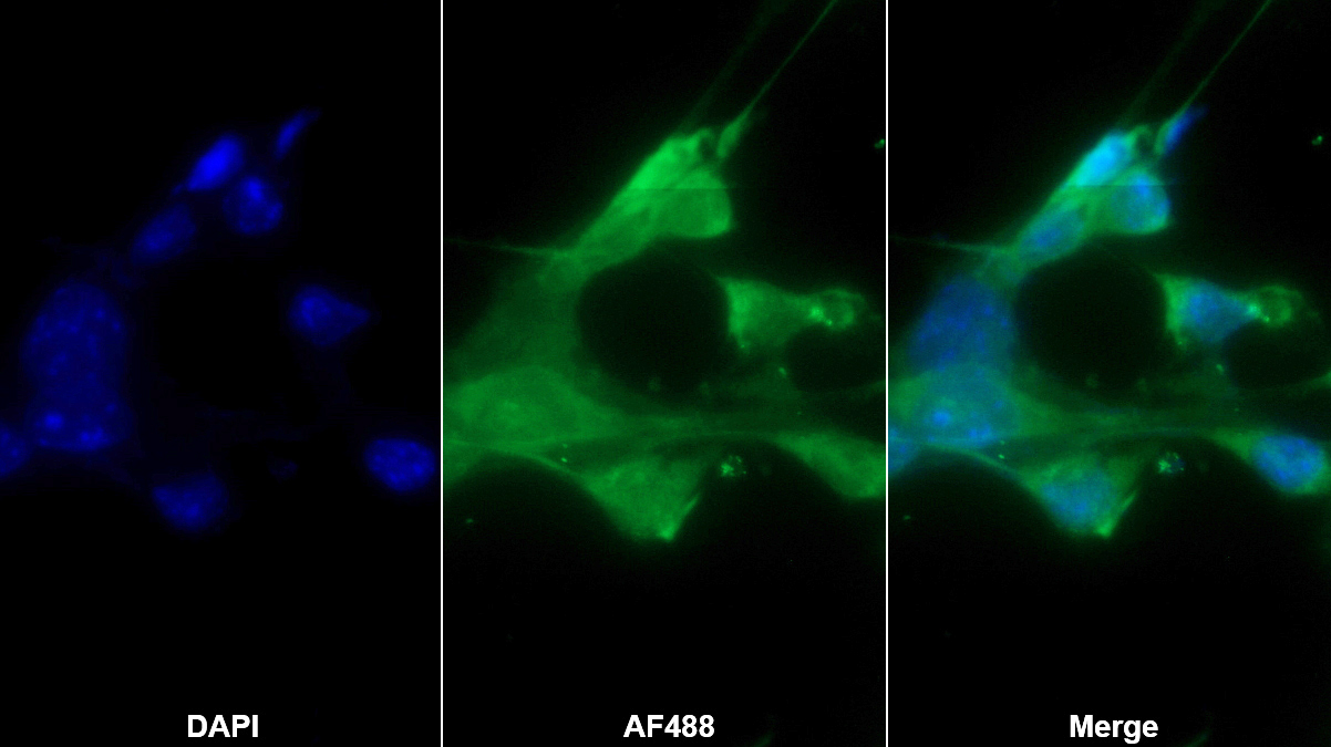 甘露聚糖結(jié)合凝集素關(guān)聯(lián)絲氨酸蛋白酶1(MASP1)多克隆抗體
