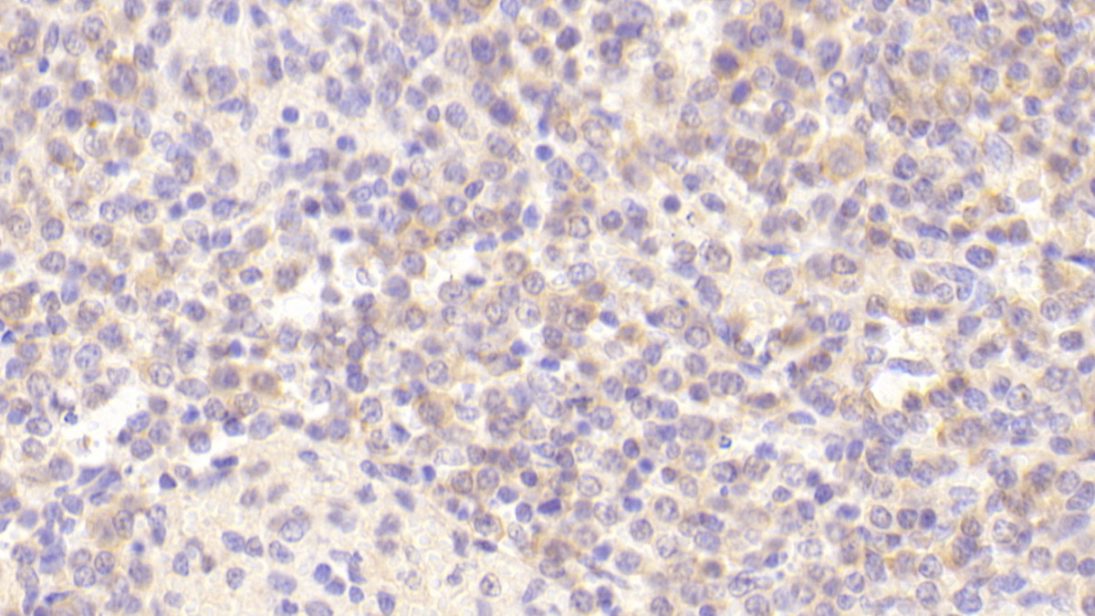 烟碱型胆碱受体α4(CHRNa4)多克隆抗体