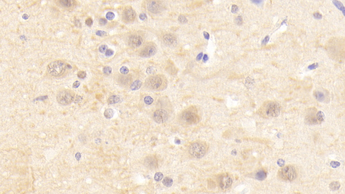 烟碱型胆碱受体α4(CHRNa4)多克隆抗体