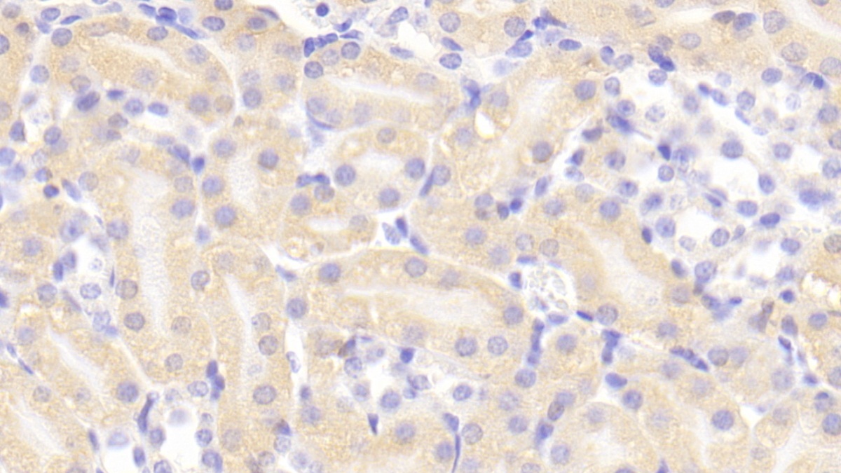 烟碱型胆碱受体α4(CHRNa4)多克隆抗体