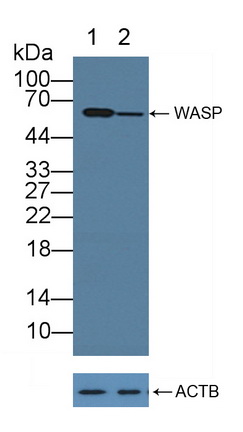 免疫缺陷伴血小板减少综合征蛋白(WASP)多克隆抗体