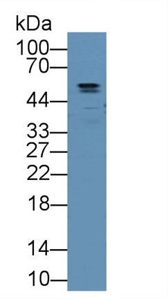 血管生成素樣蛋白2(ANGPTL2)多克隆抗體