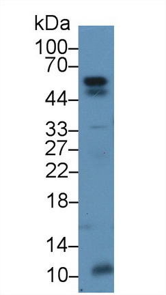 血管生成素樣蛋白2(ANGPTL2)多克隆抗體