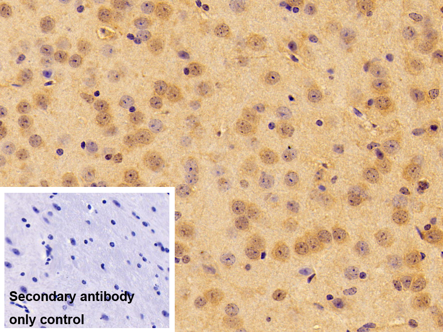 胆碱乙酰转移酶(ChAT)多克隆抗体