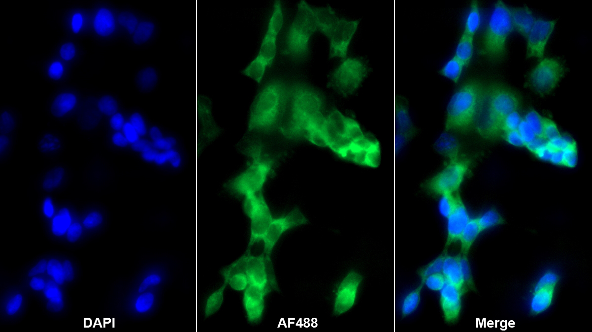 胆碱乙酰转移酶(ChAT)多克隆抗体