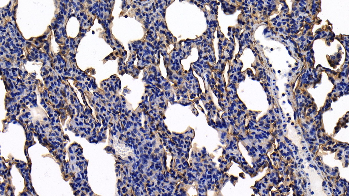 膜聯(lián)蛋白A2(ANXA2)多克隆抗體