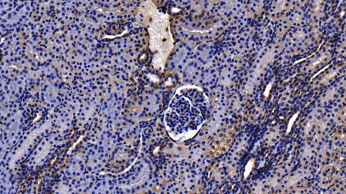 膜聯(lián)蛋白A2(ANXA2)多克隆抗體