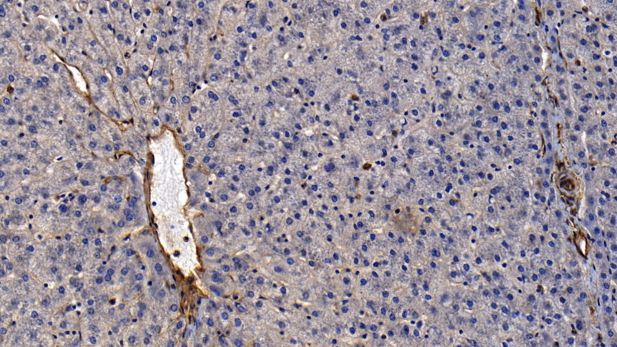 膜聯(lián)蛋白A2(ANXA2)多克隆抗體