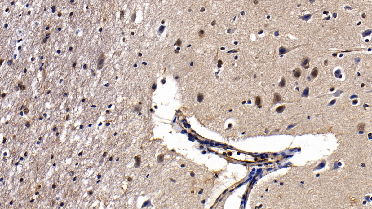 膜聯(lián)蛋白A2(ANXA2)多克隆抗體