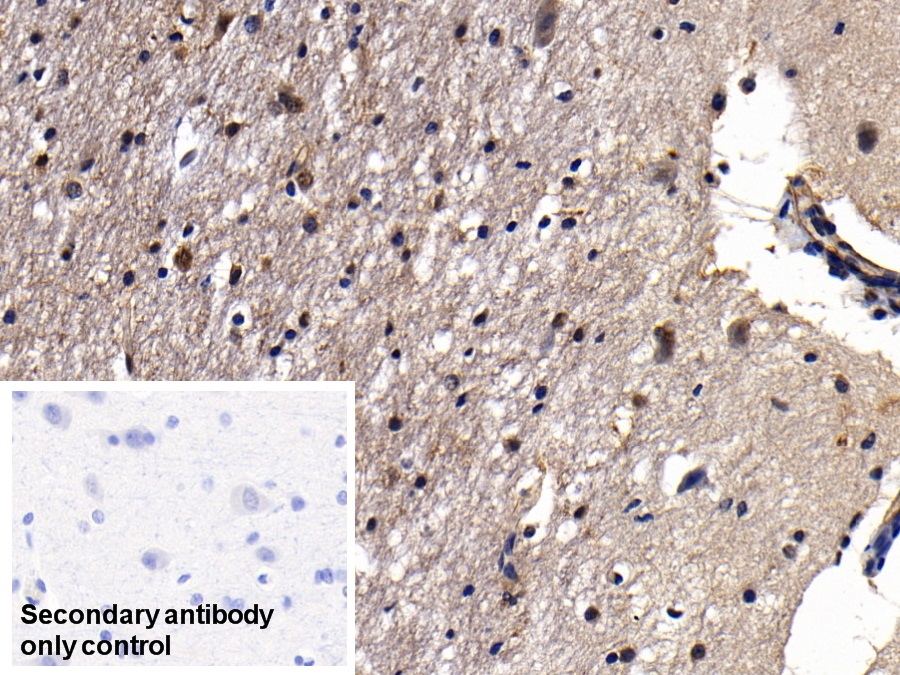 膜聯(lián)蛋白A2(ANXA2)多克隆抗體