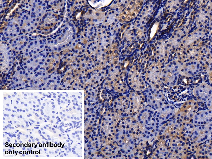 膜聯(lián)蛋白A2(ANXA2)多克隆抗體