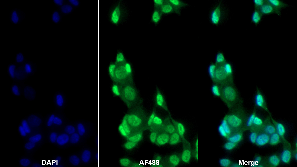 43kDa Tar DNA結(jié)合蛋白(TDP43)多克隆抗體