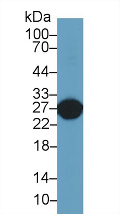 谷胱甘肽S轉(zhuǎn)移酶α5(GSTa5)多克隆抗體