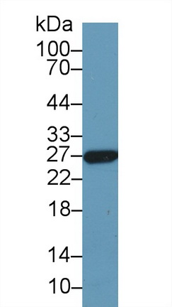 谷胱甘肽S轉(zhuǎn)移酶α5(GSTa5)多克隆抗體