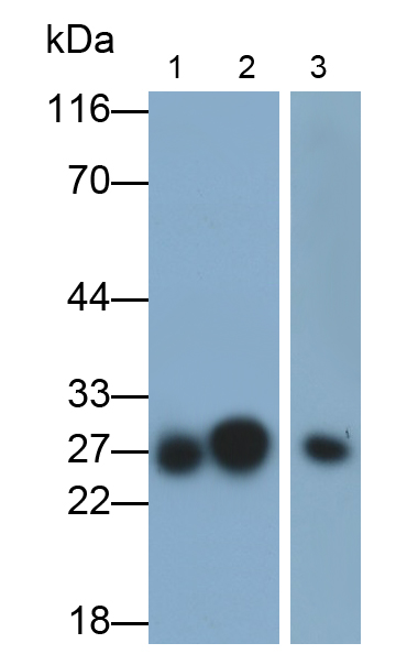 谷胱甘肽S轉(zhuǎn)移酶α5(GSTa5)多克隆抗體