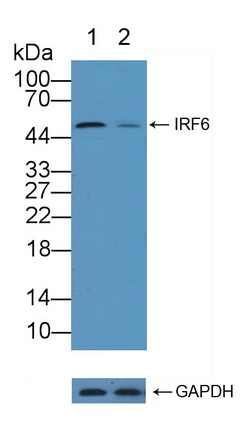 干扰素调节因子6(IRF6)多克隆抗体