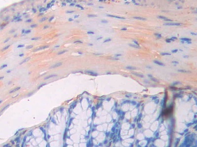 CD34分子(CD34)多克隆抗體