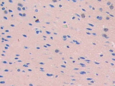 CD34分子(CD34)多克隆抗體