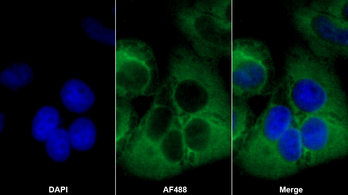 鈣蛋白酶1(CAPN1)多克隆抗體
